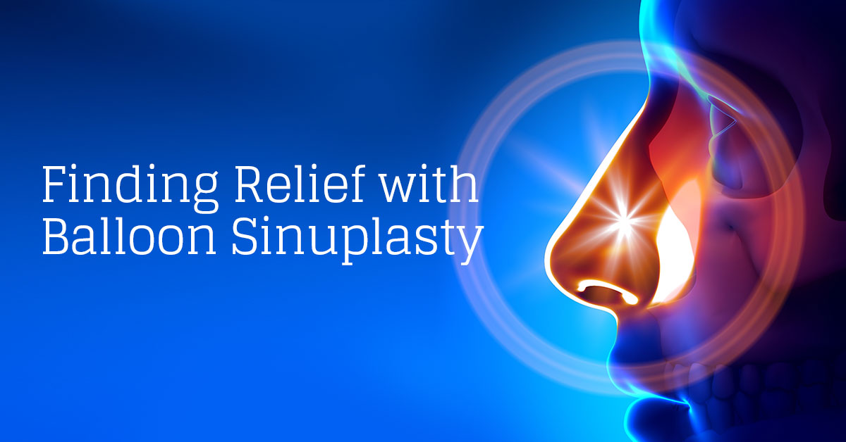 Balloon Sinuplasty Procedure Alamo ENT Associates