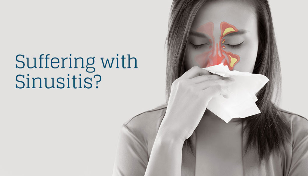 Sinusitis Causes & Symptoms Alamo ENT Associates